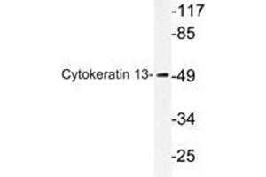 Western blot analysis of Cytokeratin 13 antibody in extracts from HepG2 cells. (Cytokeratin 13 anticorps)