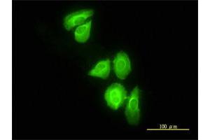Immunofluorescence of monoclonal antibody to DNAJC3 on HeLa cell.