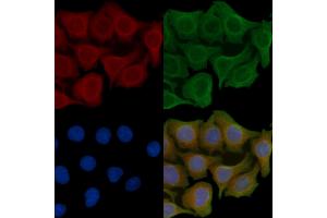 anti-Neural Cell Adhesion Molecule 2 (NCAM2) (Internal Region) antibody