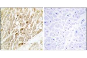 Immunohistochemistry analysis of paraffin-embedded human heart tissue, using CBF beta Antibody.
