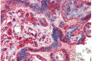 Human Placenta (formalin-fixed, paraffin-embedded) stained with ATF4 antibody ABIN462203 followed by biotinylated goat anti-rabbit IgG secondary antibody ABIN481713, alkaline phosphatase-streptavidin and chromogen.