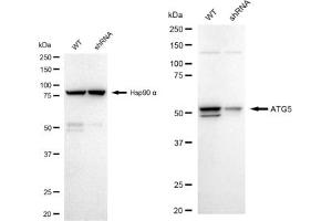Western blotting analysis using ATG5 antibody (ABIN7797674).