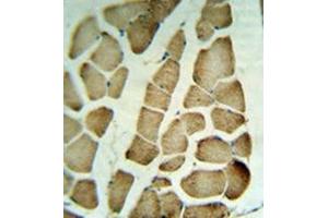 Immunohistochemistry analysis in formalin fixed and paraffin embedded human skeletal muscle tissue reacted with PARVA Antibody (C-term) Cat.