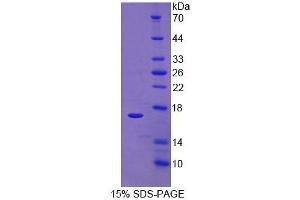 SDS-PAGE of Protein Standard from the Kit  (Highly purified E. (RALBP1 Kit ELISA)