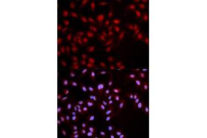 Immunofluorescence analysis of U2OS cell using Phospho-MET-Y1349 antibody. (c-MET anticorps  (pTyr1349))