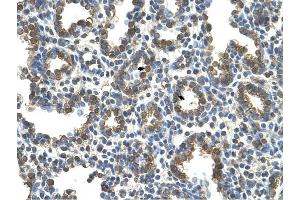 SLC37A3 antibody was used for immunohistochemistry at a concentration of 4-8 ug/ml to stain Alveolar cells (arrows) in Human Lung. (SLC37A3 anticorps)