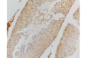 ABIN6255690 and ABIN6267427 at 1/100 staining human testis tissue by IHC-P. (EIF2AK2 anticorps  (pThr446))