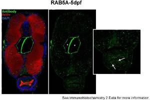Sample type: zebra gut epithelial cellsGreen: primaryRed: actinBlue: DAPIPrimary dilution: 1:5000Secondary Dilution: 1:300Image Submitted by: Michel BagnatDuke University Medical Center .