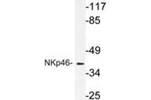 Western blot (WB) analysis of NKp46 antibody in extracts from A549 cells. (NCR1 anticorps)