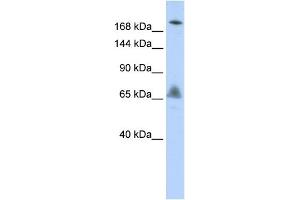 WB Suggested Anti-VPS8 Antibody Titration:  0. (VPS8 anticorps  (N-Term))