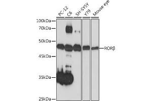 Western blot analysis of extracts of various cell lines, using RORβ Rabbit mAb (ABIN7269855) at 1:1000 dilution. (RORB anticorps)