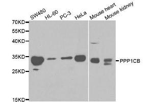 Western blot analysis of extracts of various cell lines, using PPP1CB antibody. (PPP1CB anticorps  (AA 1-327))