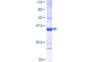 Image no. 1 for Interleukin 18 Receptor Accessory Protein (IL18RAP) (AA 20-129) protein (GST tag) (ABIN1307728)
