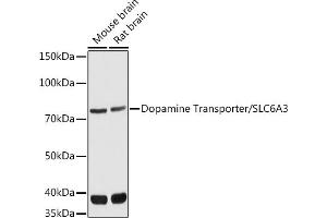 Western blot analysis of extracts of various cell lines, using Dopamine Transporter/SLC6 antibody (ABIN7270474) at 1:1000 dilution. (SLC6A3 anticorps  (C-Term))