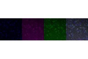 Immunohistochemistry (IHC) image for anti-Transient Receptor Potential Cation Channel, Subfamily C, Member 6 (TRPC6) antibody (ABIN7456164)