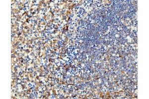 IHC analysis of ICAM1 using anti-ICAM1 antibody (ABIN7601066).