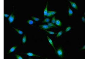 Immunofluorescent analysis of Hela cells using ABIN7154428 at dilution of 1:100 and Alexa Fluor 488-congugated AffiniPure Goat Anti-Rabbit IgG(H+L) (FAM59A anticorps  (AA 12-320))