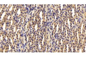 Detection of ADPN in Rat Kidney Tissue using Polyclonal Antibody to Adiponectin (ADPN) (ADIPOQ anticorps  (AA 111-244))