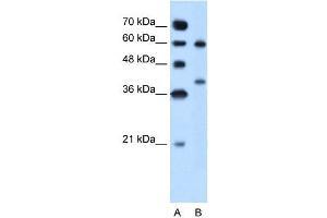 Arginase 1 antibody used at 5 ug/ml to detect target protein. (Liver Arginase anticorps  (Arg1, N-Term))