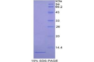 SDS-PAGE analysis of Mouse ARPC4 Protein. (ARPC4 Protéine)