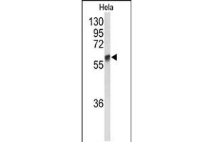 Western blot analysis of GALNT2 Antibody in Hela cell line lysates (35ug/lane) (GALNT2 anticorps  (N-Term))