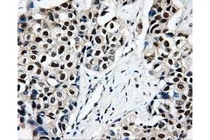 Immunohistochemical staining of paraffin-embedded Kidney tissue using anti-CISD1mouse monoclonal antibody.
