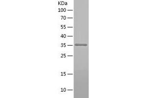Western Blotting (WB) image for Survival of Motor Neuron 1, Telomeric (SMN1) (AA 165-294) protein (His-IF2DI Tag) (ABIN7125137)