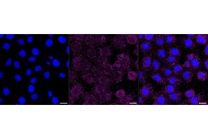 Immunocytochemical staining of HT- cells with Ribophorin I antibody (ABIN7800214), 1:1,000). (Recombinant RPN1 anticorps)