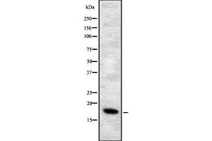 Western blot analysis of ALOX5AP using HepG2 whole cell lysates