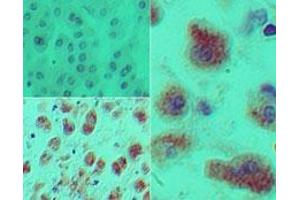 Image no. 1 for anti-Dachshund 1 (DACH1) (AA 474-491) antibody (ABIN960126)