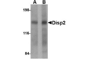 Western blot analysis of Disp2 in rat brain tissue lysate with AP30293PU-N Disp2 antibody at (A) 1 and (B) 2 μg/ml. (DISP2 anticorps  (C-Term))