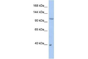 WB Suggested Anti-NEDD4L Antibody Titration:  0. (NEDD4-2 anticorps  (Middle Region))