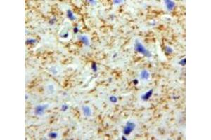 Used in DAB staining on fromalin fixed paraffin-embedded Brain tissue