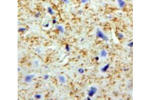 Used in DAB staining on fromalin fixed paraffin-embedded Brain tissue (PNOC anticorps  (AA 20-176))