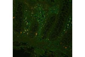 Image no. 3 for anti-Tumor Necrosis Factor alpha (TNF alpha) antibody (ABIN799618) (TNF alpha anticorps)