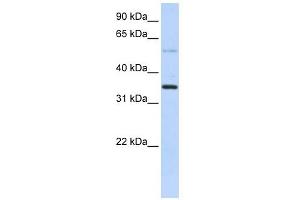 ANKRD9 antibody used at 1 ug/ml to detect target protein. (ANKRD9 anticorps  (Middle Region))