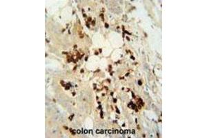 Immunohistochemistry (IHC) image for anti-DDB1 and CUL4 Associated Factor 4-Like 2 (DCAF4L2) antibody (ABIN2995734)