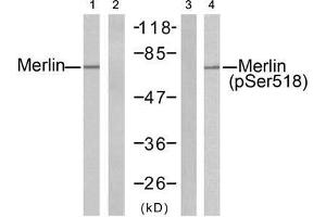 Western blot analysis of extracts from H (Merlin anticorps)
