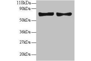 Western blot All lanes: CCL5 antibody at 2 μg/mL Lane 1: EC109 whole cell lysate Lane 2: 293T whole cell lysate Secondary Goat polyclonal to rabbit IgG at 1/15000 dilution Predicted band size: 10 kDa Observed band size: 70 kDa (CCL5 anticorps  (AA 24-91))