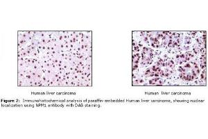 Image no. 1 for anti-Nucleophosmin (Nucleolar phosphoprotein B23, Numatrin) (NPM1) antibody (ABIN207591) (NPM1 anticorps)