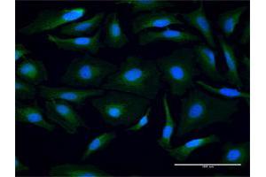 Immunofluorescence of purified MaxPab antibody to PSMB3 on HeLa cell. (PSMB3 anticorps  (AA 1-205))