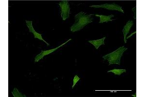 Immunofluorescence of monoclonal antibody to PLEK on HeLa cell.