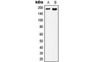 Western blot analysis of IQGAP3 expression in MCF7 (A), HepG2 (B) whole cell lysates.