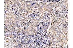 IHC analysis of COL6A1 using anti-COL6A1 antibody (ABIN7600515).