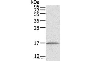 Western blot analysis of Human normal liver tissue, using EVA1A Polyclonal Antibody at dilution of 1:550 (TMEM166 anticorps)