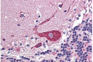 Human Brain, Cerebellum: Formalin-Fixed, Paraffin-Embedded (FFPE)