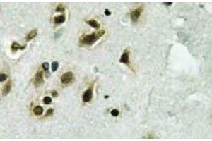 Immunohistochemistry  (IHC) analyzes of TFIIIC102 antibody in paraffin-embedded human brain tissue. (GTF3C3 anticorps)