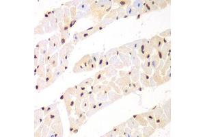 Immunohistochemistry of paraffin-embedded mouse heart using Nono Antibody. (NONO anticorps  (AA 1-300))