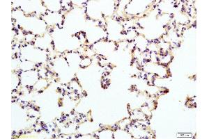 Formalin-fixed and rat lung tissue labeled with Anti-IL12RB2 Polyclonal Antibody , Unconjugated at 1:200 followed by conjugation to the secondary antibody and DAB staining (IL12RB2 anticorps  (AA 301-400))