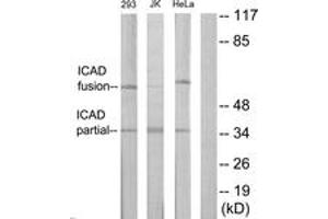 Western blot analysis of extracts from Jurkat/293/HeLa cells, using DFFA Antibody. (DFFA anticorps  (AA 151-200))